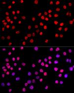 c-Jun Antibody in Immunocytochemistry (ICC/IF)