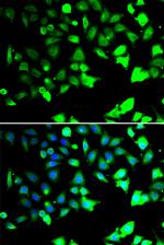 XIAP Antibody in Immunocytochemistry (ICC/IF)