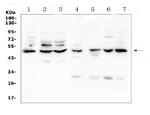 TNFR1 Antibody in Western Blot (WB)