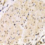 TMPRSS2 Antibody in Immunohistochemistry (IHC)