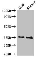 TRADD Antibody in Western Blot (WB)