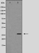 Phospho-Caveolin 2 (Tyr27) Antibody in Western Blot (WB)