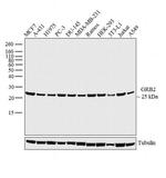 GRB2 Antibody in Western Blot (WB)