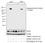 Phospho-EGFR (Tyr1068) Antibody in Western Blot (WB)