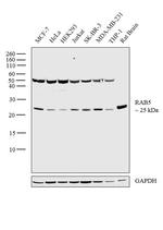 RAB5 Antibody in Western Blot (WB)