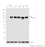 IFI16 Antibody in Western Blot (WB)