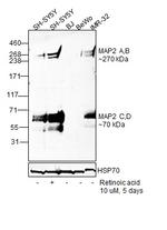 MAP2 Antibody in Western Blot (WB)