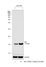 Human VEGF-165 Protein in Functional Assay (Functional)