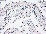 PLK1 Antibody in Immunohistochemistry (Paraffin) (IHC (P))