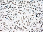 PLK1 Antibody in Immunohistochemistry (Paraffin) (IHC (P))