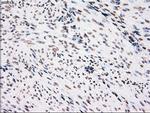 PLK1 Antibody in Immunohistochemistry (Paraffin) (IHC (P))