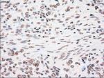 PLK1 Antibody in Immunohistochemistry (Paraffin) (IHC (P))