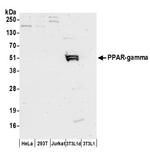 PPAR-gamma Antibody in Western Blot (WB)