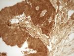 PRMT5 Antibody in Immunohistochemistry (Paraffin) (IHC (P))