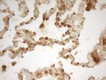 PRMT5 Antibody in Immunohistochemistry (Paraffin) (IHC (P))