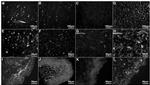 Parvalbumin Antibody in Immunohistochemistry (IHC)