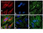 Mouse IgG (H+L) Secondary Antibody in Immunocytochemistry (ICC/IF)