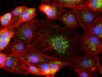 Rabbit IgG (H+L) Cross-Adsorbed Secondary Antibody in Immunocytochemistry (ICC/IF)