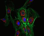 Rabbit IgG (H+L) Secondary Antibody in Immunocytochemistry (ICC/IF)