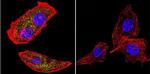 RAB9 Antibody in Immunocytochemistry (ICC/IF)