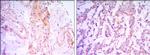 RICTOR Antibody in Immunohistochemistry (Paraffin) (IHC (P))