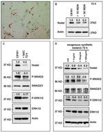 ERK1/ERK2 Antibody in Western Blot (WB)