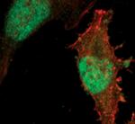 SMAD2 Antibody in Immunocytochemistry (ICC/IF)