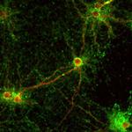 Synaptophysin Antibody in Immunocytochemistry (ICC/IF)