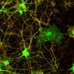 Synaptophysin Antibody in Immunocytochemistry (ICC/IF)