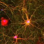 Synaptophysin Antibody in Immunocytochemistry (ICC/IF)