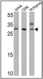 TCR V alpha 12.1 Antibody in Western Blot (WB)