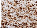 HBcAg Antibody in Immunohistochemistry (Paraffin) (IHC (P))