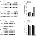 beta Amyloid Antibody in Western Blot (WB)