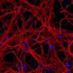 beta-3 Tubulin Antibody in Immunocytochemistry (ICC/IF)