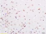 PAX3 Antibody in Immunohistochemistry (Paraffin) (IHC (P))