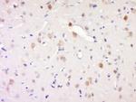 Synaptojanin 1 Antibody in Immunohistochemistry (Paraffin) (IHC (P))