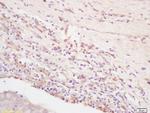 Integrin Alpha V + Beta 3 Antibody in Immunohistochemistry (Paraffin) (IHC (P))