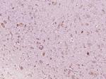 IFNAR1 Antibody in Immunohistochemistry (Paraffin) (IHC (P))