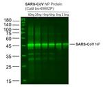 SARS Nucleocapsid Protein Antibody in Western Blot (WB)