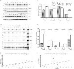 Phospho-Tau (Ser404) Antibody in Western Blot (WB)