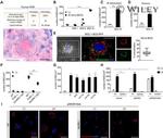 Nitrotyrosine Antibody in Immunohistochemistry (IHC)