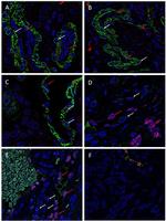 SOX2 Antibody in Immunohistochemistry (IHC)