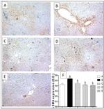 Actin Antibody in Immunohistochemistry (IHC)