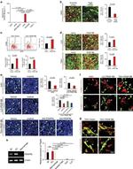 CD140a (PDGFRA) Antibody in Immunohistochemistry (Paraffin) (IHC (P))