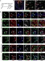 CD140a (PDGFRA) Antibody in Immunohistochemistry (IHC)