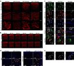 CD4 Antibody in Immunohistochemistry (IHC)