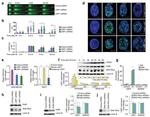 Ku80 Antibody in Immunoprecipitation (IP)