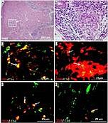 CD3 Antibody in Immunohistochemistry (IHC)