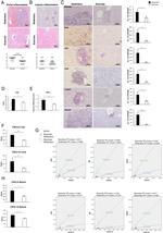 FOXP3 Antibody in Immunohistochemistry (IHC)