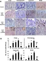 Cyclin D1 Antibody in Immunohistochemistry (IHC)